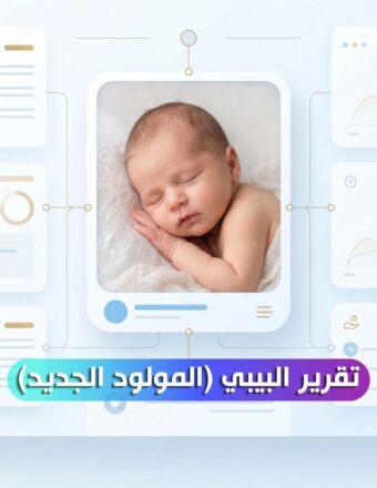 تقرير البيبي (المولود الجديد)